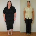 Weight Loss in Miramar, Florida