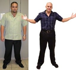 Weight Loss Resources in Aventura, Florida