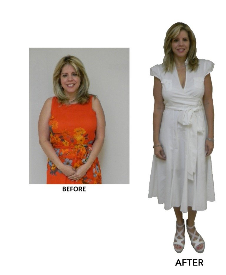 Weight Loss Resources in Sunrise, Florida