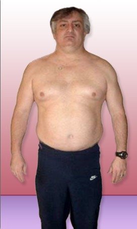 Is Stress Eating Hurting Your Weight Loss Efforts?