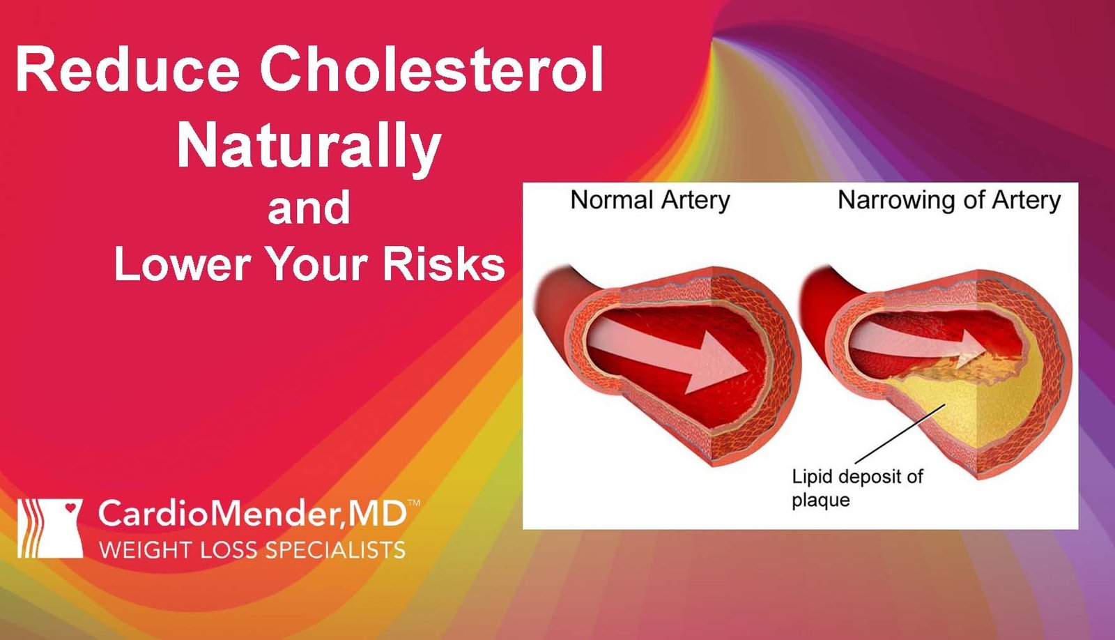 How to Reduce Cholesterol Naturally Using Plant Sterols and Stanols